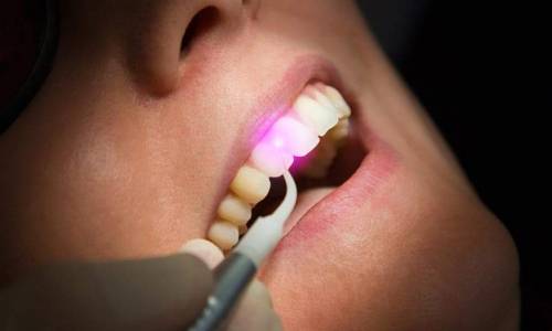 Best Dental checkup in kochi